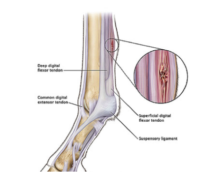 Injured tendon